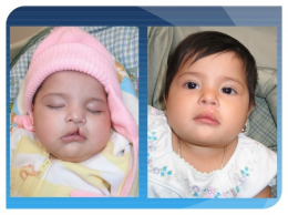 gallery/pediatric-plastic-surgery-5-638